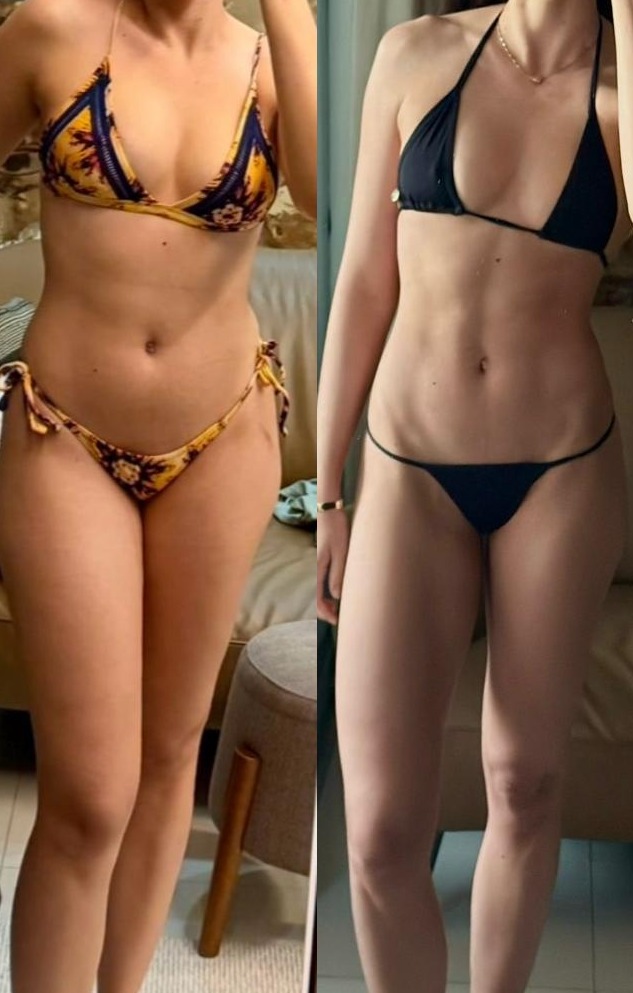 Transformação antes e depois — aluna 1
